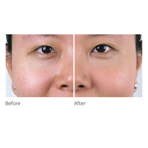 Freezeframe BB Blur Skin Tint 30mL