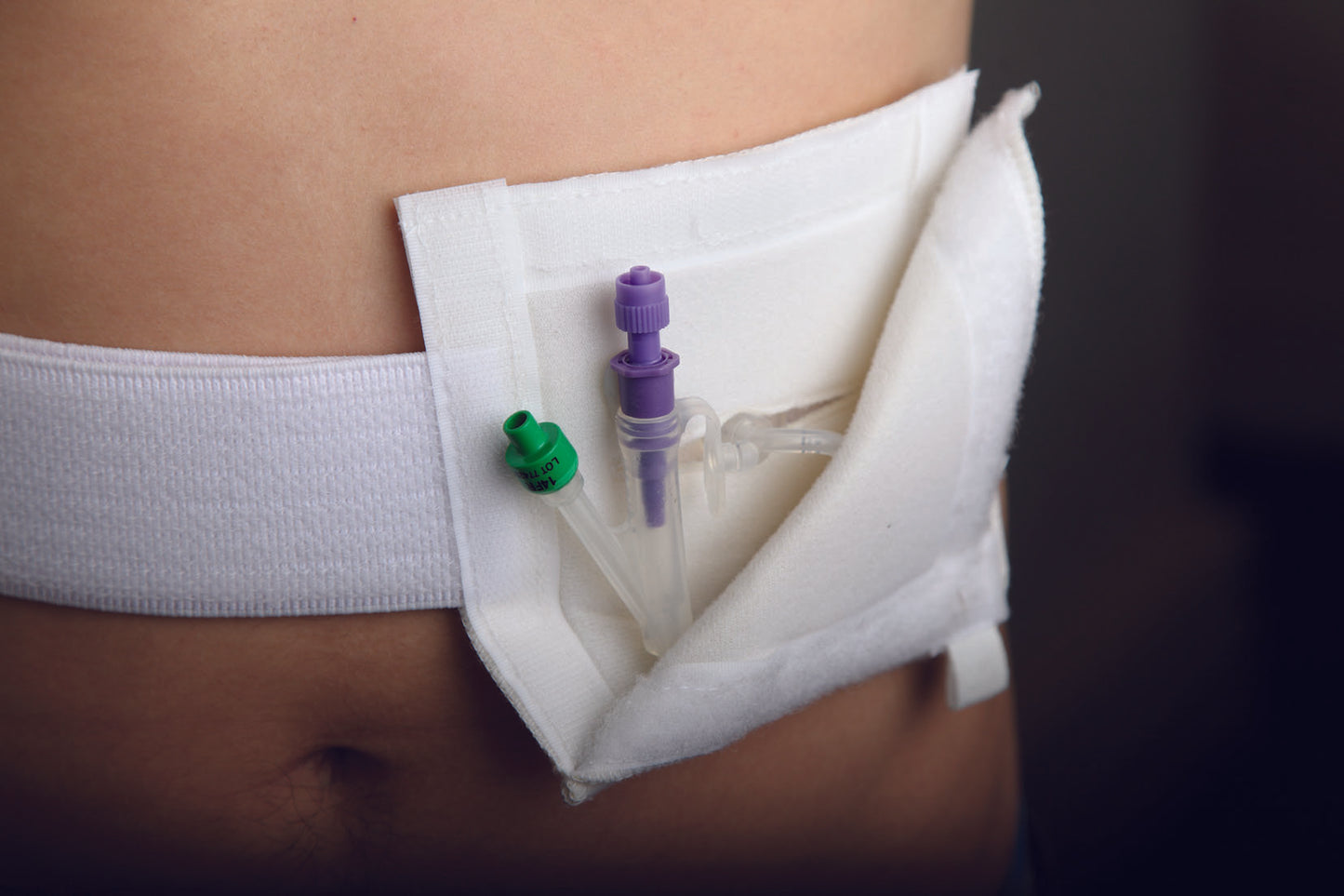 Gastrostomy Tidy Medium (75Cm-114Cm)