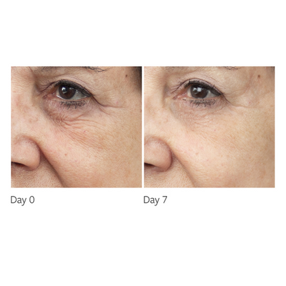 Freezeframe RevitalEYES 15mL