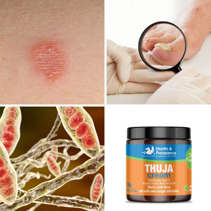 Martin & Pleasance Herbal Cream – Natural Thuja Cream